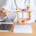 Médico con modelo de anatomía del colon humano. Cáncer de colon, enfermedad colónica, intestino grueso, cáncer colorrectal, colitis ulcerosa, diverticulitis, síndrome del intestino irritable, sistema digestivo y concepto de salud