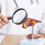 Médico con modelo de hígado humano y lupa. Explica como limpiar el higado para evitar cáncer y tumor de hígado.