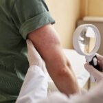 Nacidos: Causas, Síntomas, Prevención y Tratamiento